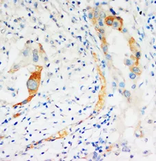 Caspase 2 (CASP2) (C-term) Rabbit Polyclonal Antibody - image 1