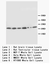 SCN1B (N-term) Rabbit Polyclonal Antibody - image 1