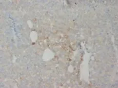 CD18 (ITGB2) (N-term) Rabbit Polyclonal Antibody - image 1