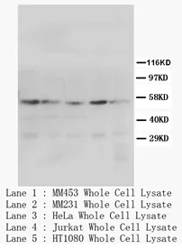 PPAR gamma (PPARG) (N-term) Rabbit Polyclonal Antibody - image 1