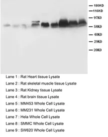 SMAD1 (C-term) Rabbit Polyclonal Antibody - image 1