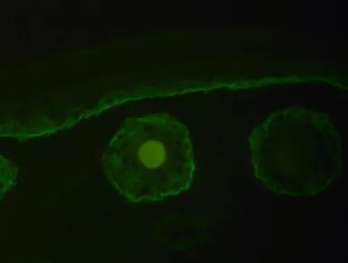 Col17a1 Rabbit Polyclonal Antibody - image 1