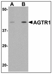 Angiotensin II Type 1 Receptor (AGTR1) Rabbit Polyclonal Antibody - image 1