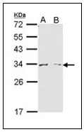 Arginase 1 (ARG1) (1-145) Rabbit Polyclonal Antibody - image 1
