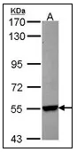 Cytochrome P450 26B (CYP26B1) (160-396) Rabbit Polyclonal Antibody - image 1