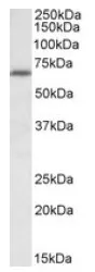 Ikaros (IKZF1) Goat Polyclonal Antibody - image 1
