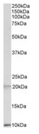 alpha Defensin 1 (DEFA1) (+Defensin alpha 3) Goat Polyclonal Antibody - image 1