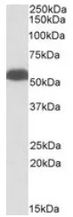 GLUD1 (+Glutamate dehydrogenase 2) Goat Polyclonal Antibody - image 1