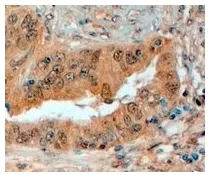 Semaphorin 3E (SEMA3E) Goat Polyclonal Antibody - image 1