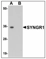Synaptogyrin 1 (SYNGR1) Rabbit Polyclonal Antibody - image 1