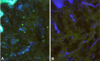 CCBE1 Rabbit Polyclonal Antibody - image 1