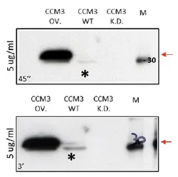 PDCD10 Rabbit Polyclonal Antibody - image 1