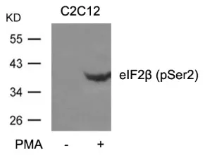 EIF2S2 pSer2 Rabbit Polyclonal Antibody - image 1