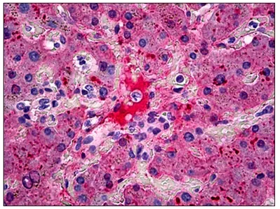 Fibrinogen Rabbit Polyclonal Antibody - image 1