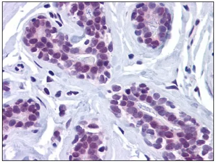 CtIP (RBBP8) Rabbit Polyclonal Antibody - image 1