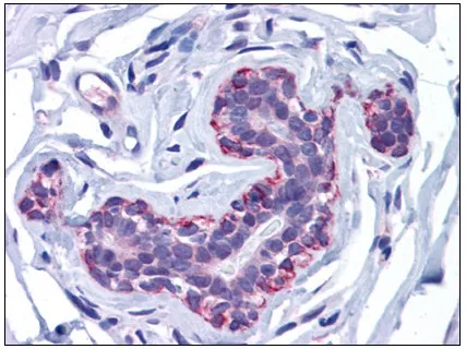 FREM2 Rabbit Polyclonal Antibody - image 1