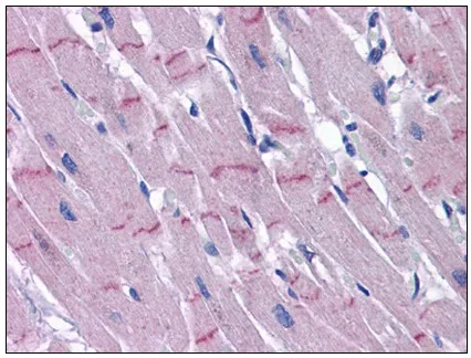 PAPP A2 (PAPPA2) (N-term) Rabbit Polyclonal Antibody - image 1