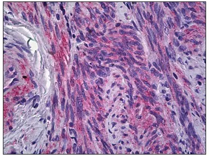 IFITM1 Rabbit Polyclonal Antibody - image 1