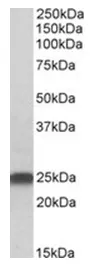 LIN7 (LIN7B) Goat Polyclonal Antibody - image 1
