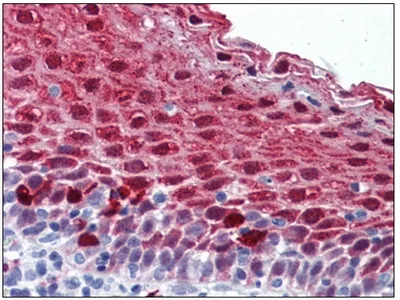 MARK4 Rabbit Polyclonal Antibody - image 1