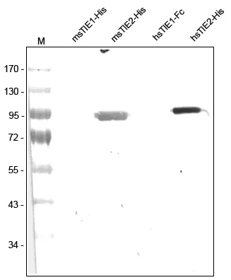 TIE2 (TEK) Rabbit Polyclonal Antibody - image 1