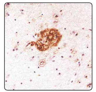 Amyloid beta (N-term) Chicken Polyclonal Antibody - image 1