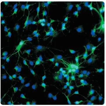 MAP2 Chicken Polyclonal Antibody - image 1