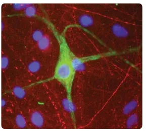 Peripherin Chicken Polyclonal Antibody - image 1