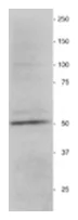 Vimentin (VIM) Chicken Polyclonal Antibody - image 1