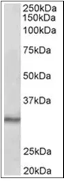 CTDSP1 Goat Polyclonal Antibody - image 1