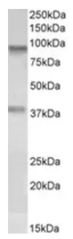 VAP1 (AOC3) Goat Polyclonal Antibody - image 1