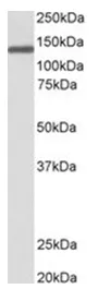 OSMR Goat Polyclonal Antibody - image 1