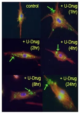 LC3B (MAP1LC3B) Cleaved Rabbit Polyclonal Antibody - image 1