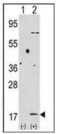 LC3B (MAP1LC3B) (C-term) Rabbit Polyclonal Antibody - image 1