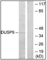 DUSP9 Rabbit Polyclonal Antibody - image 1