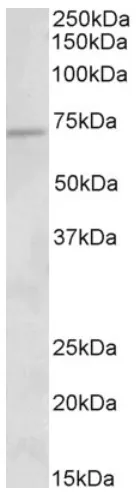 ACADVL (C-term) Goat Polyclonal Antibody - image 1