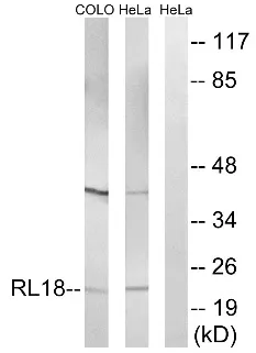 RPL18 Rabbit Polyclonal Antibody - image 1