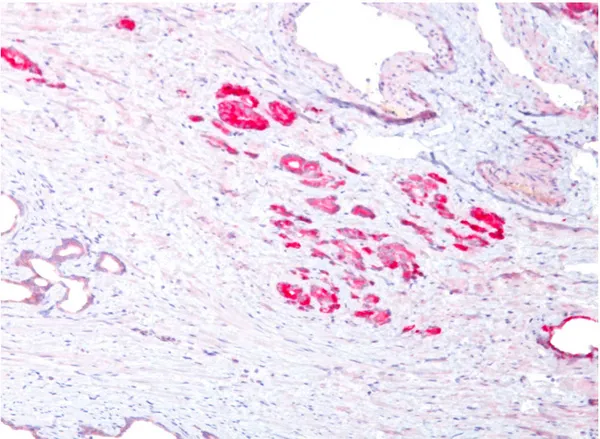 AMACR Rabbit Polyclonal Antibody - image 1