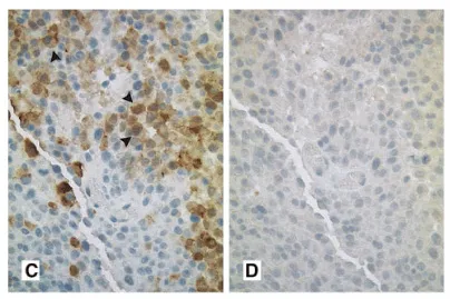 MRP8/14 (S100A8/A9) Chicken Polyclonal Antibody - image 1