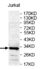 CD47 (23-140) Rabbit Polyclonal Antibody - image 1