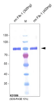 CD309 / VEGFR-2 / Flk-1 Rabbit Polyclonal Antibody - image 1