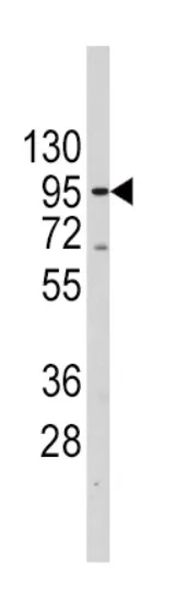 Telomerase reverse transcriptase (TERT) (627-656) Rabbit Polyclonal Antibody - image 1