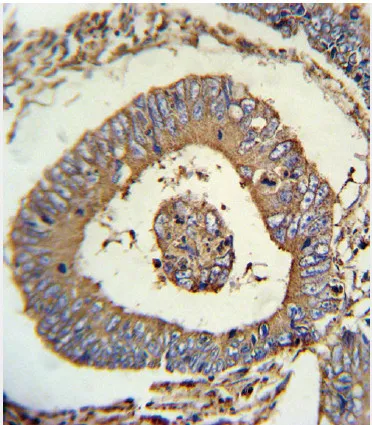 Calreticulin (CALR) Rabbit Polyclonal Antibody - image 1