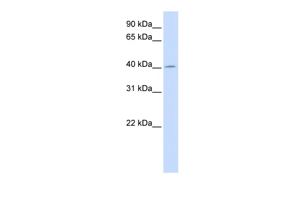 ACAA2 Rabbit Polyclonal Antibody - image 1