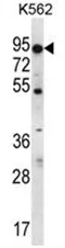 ABCD2 (C-term) Rabbit Polyclonal Antibody - image 1