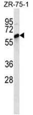 ABCG4 (N-term) Rabbit Polyclonal Antibody - image 1