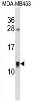 ACBD7 (C-term) Rabbit Polyclonal Antibody - image 1
