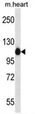 ACTN2 (C-term) Rabbit Polyclonal Antibody - image 1