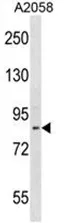 ADAM23 (C-term) Rabbit Polyclonal Antibody - image 1