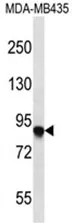 AFAP (AFAP1) (C-term) Rabbit Polyclonal Antibody - image 1